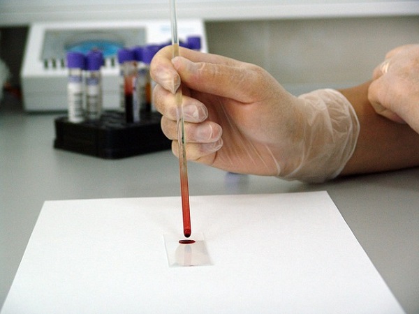 Анализ крови на антитела